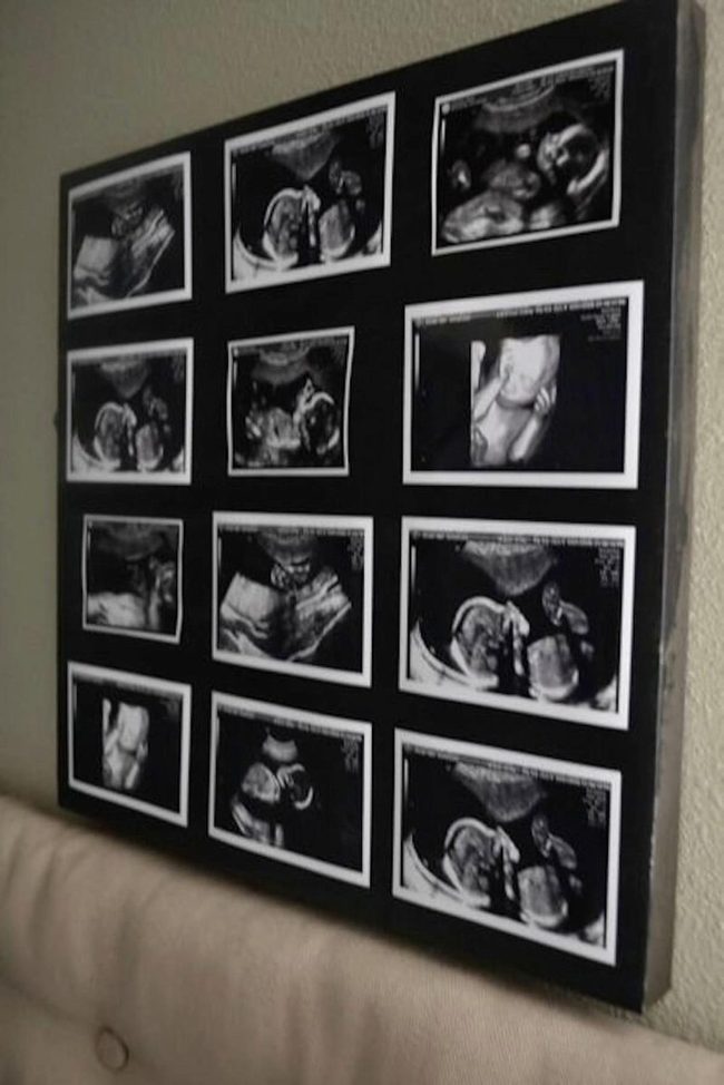 Baby'S First Portrait